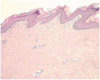 Case report: Diagnosis and autogenous vaccine treatment of herpesvirus in a green turtle (Chelonia mydas) in Santa Marta, Colombia